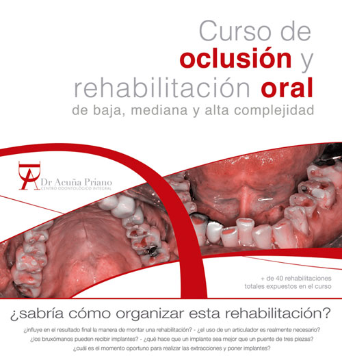 Curso de oclusion y rehabilitacion oral de baja, mediana y alta complejidad